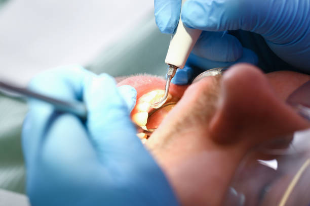 Best Emergency Treatment for Oral Infections in Fox Lake, IL